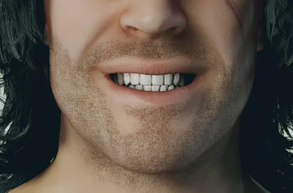 HD Teeth V1.0