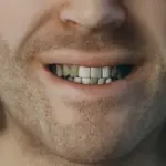 HD Teeth V1.0