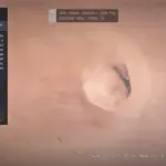 Zoom for Perfect Landing V1.0