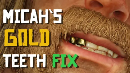 Gold-Teeth-Fix-1024x576-1
