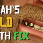 Gold-Teeth-Fix-scaled-1