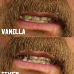 Gold-Teeth-Fix2