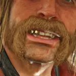 Gold-Teeth-Fix4-scaled-1