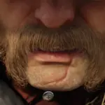 Proper-Scar-and-Better-Navel-for-Micah5
